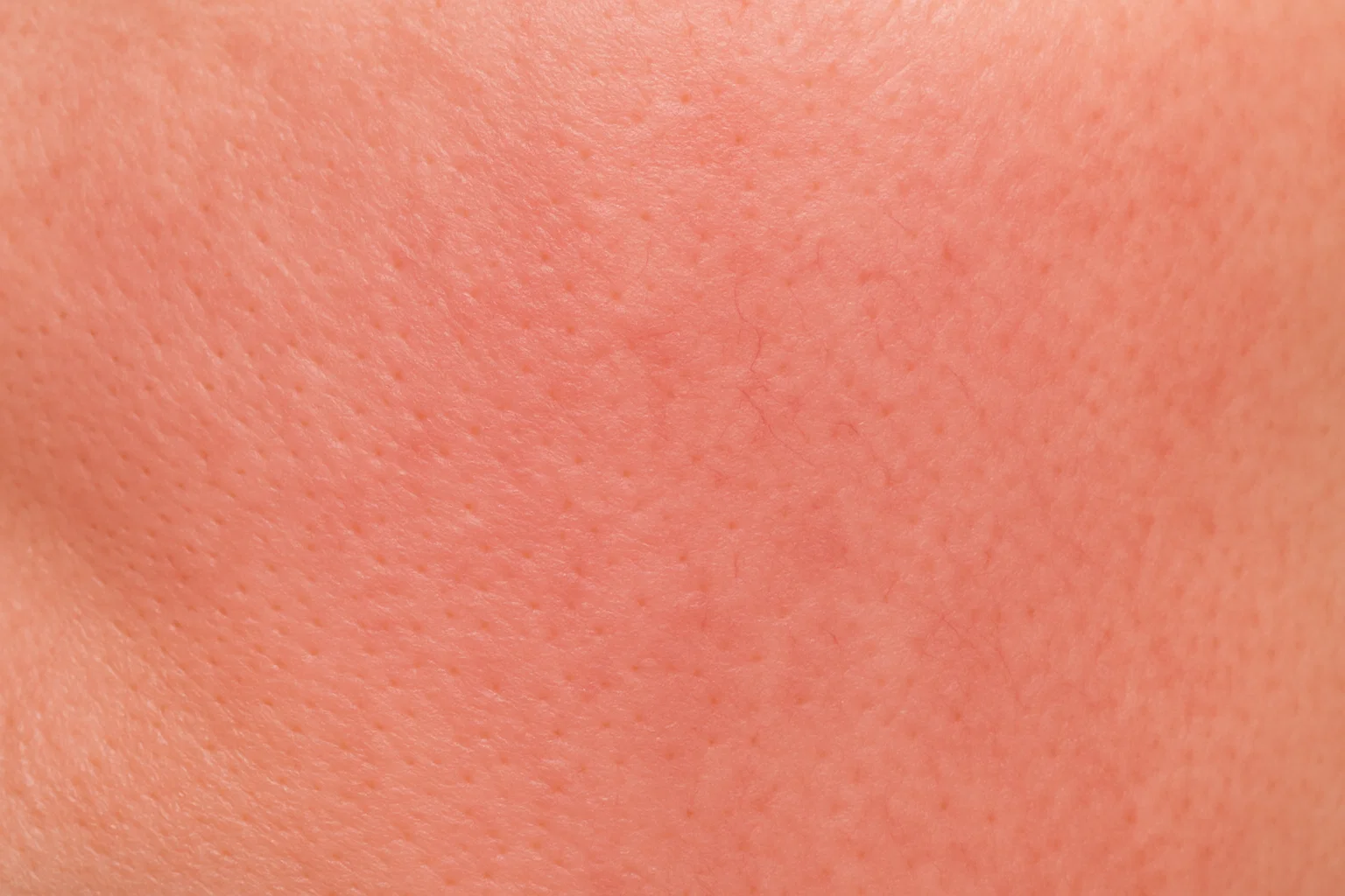 Vermelhidão/Sensibilidade